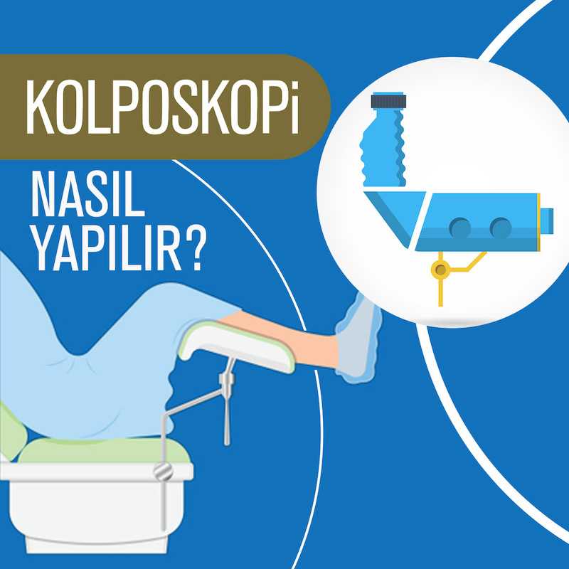 Kolposkopi Do Dr Ayd n K Kolposkopi Do Dr Ayd n K